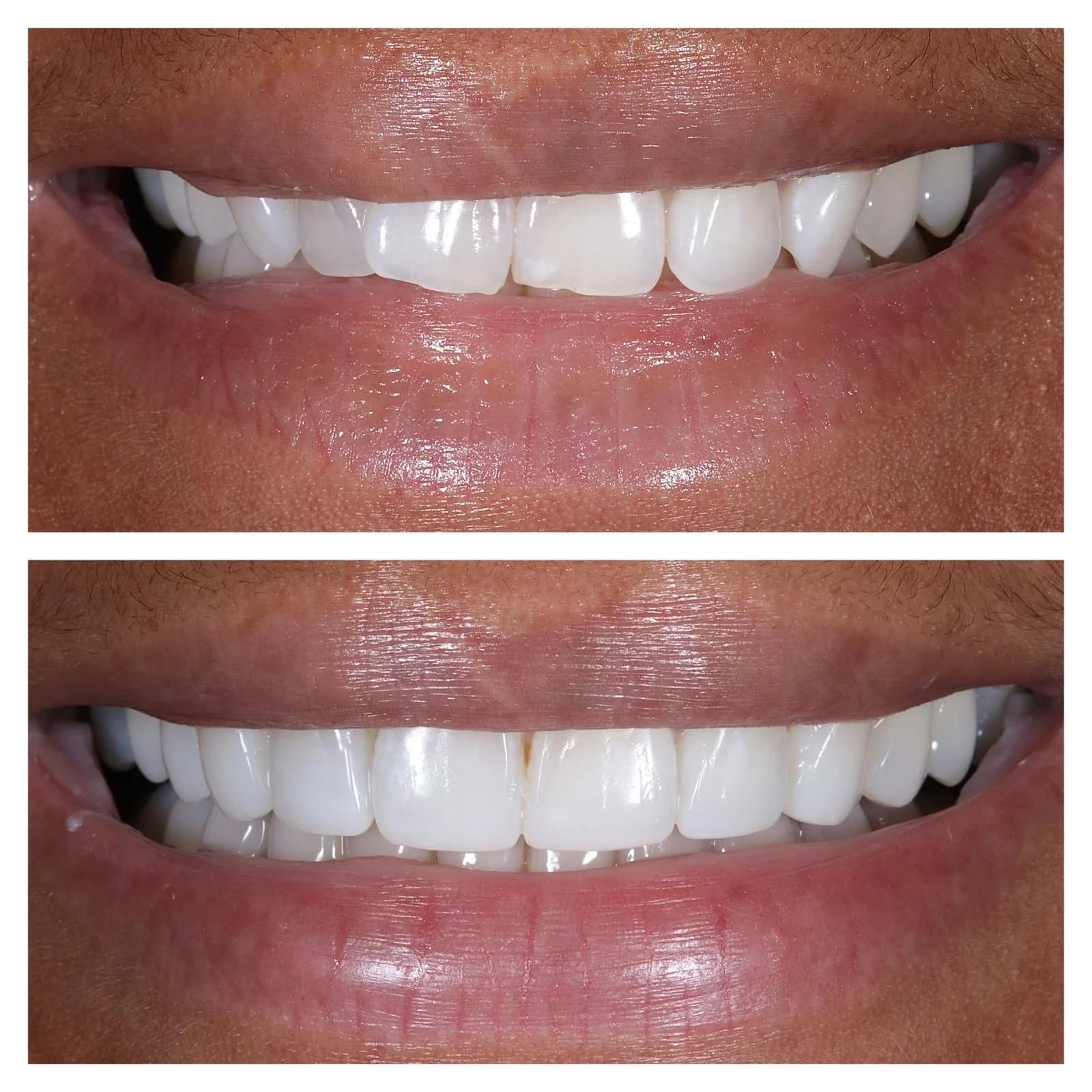 Cosmetic Dentistry