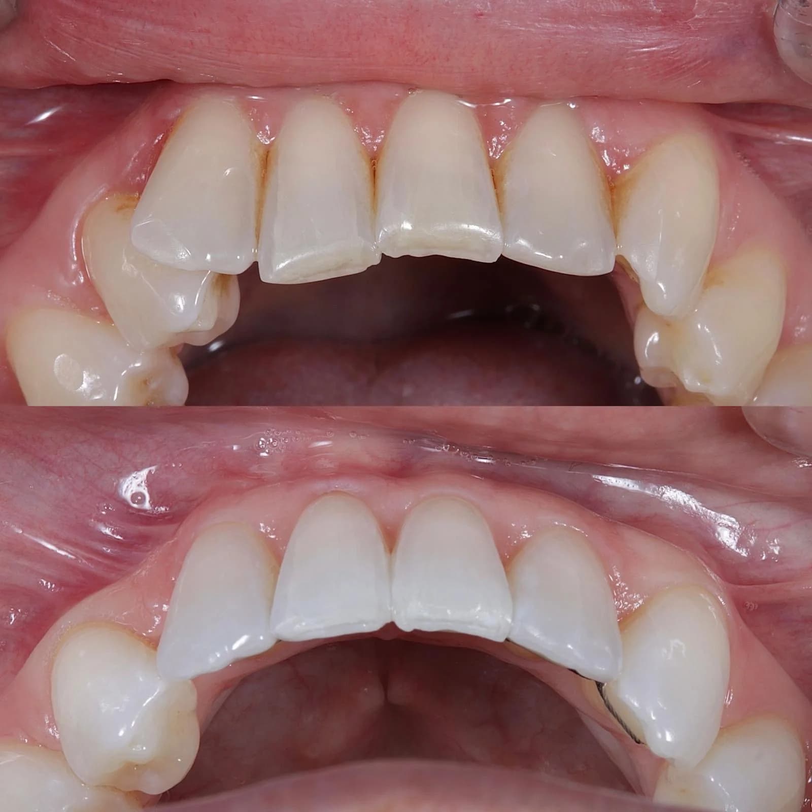 Restorative Dentistry